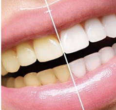 Cosmetic Dentistry