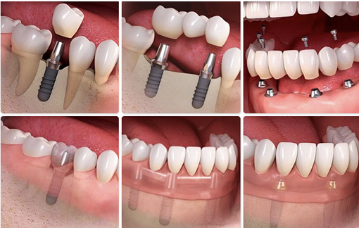 Preventive Dentistry