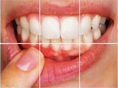 Restorative Dentistry